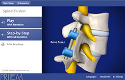 Spine medical animations